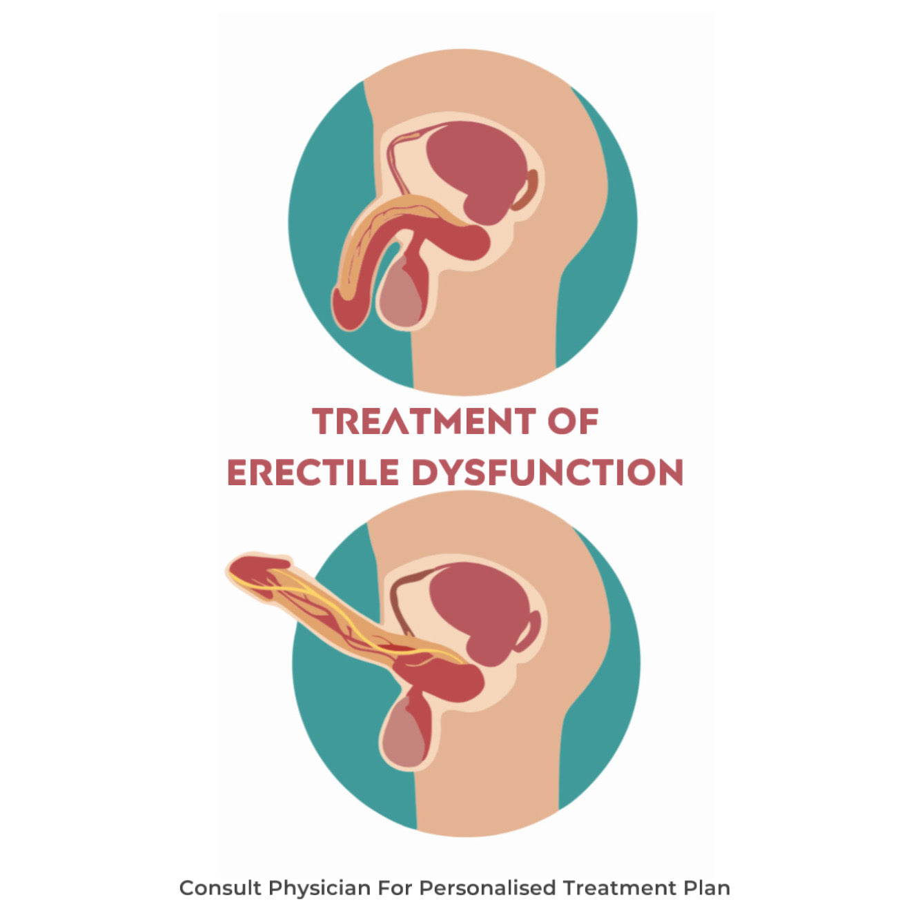 Stand-Up For Men!